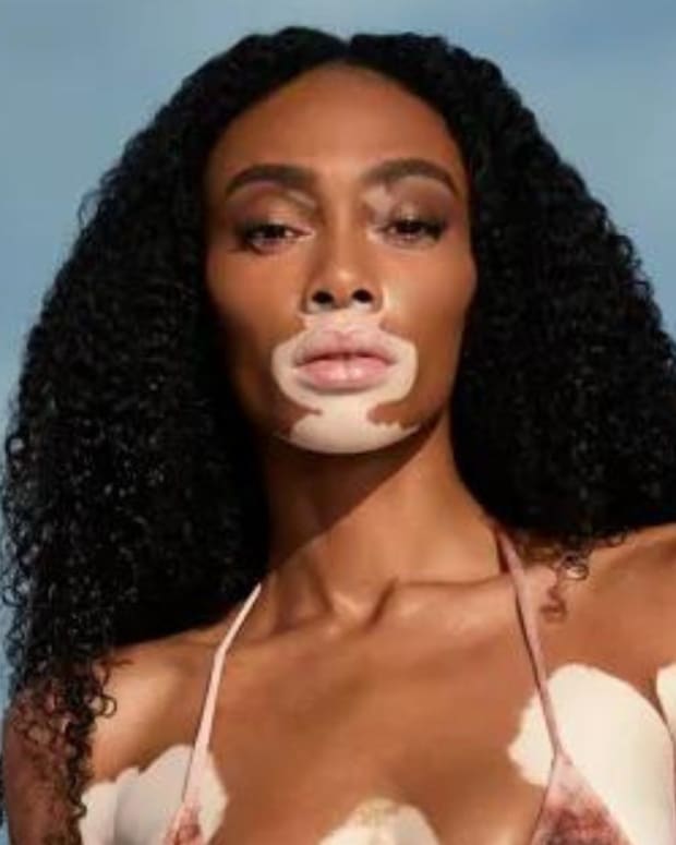 Winnie Harlow